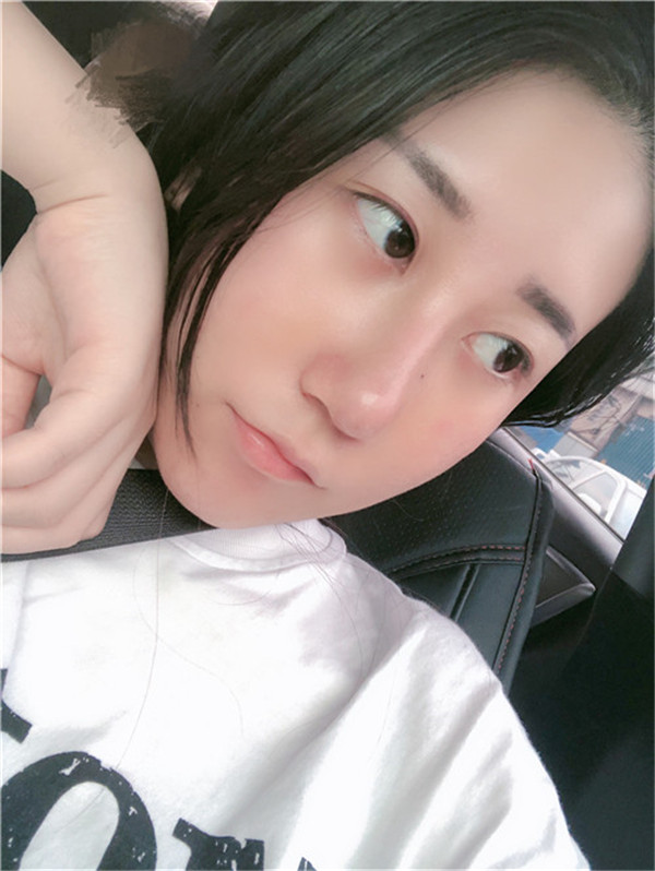广州可玫尔鼻部手术怎么样?价格案例