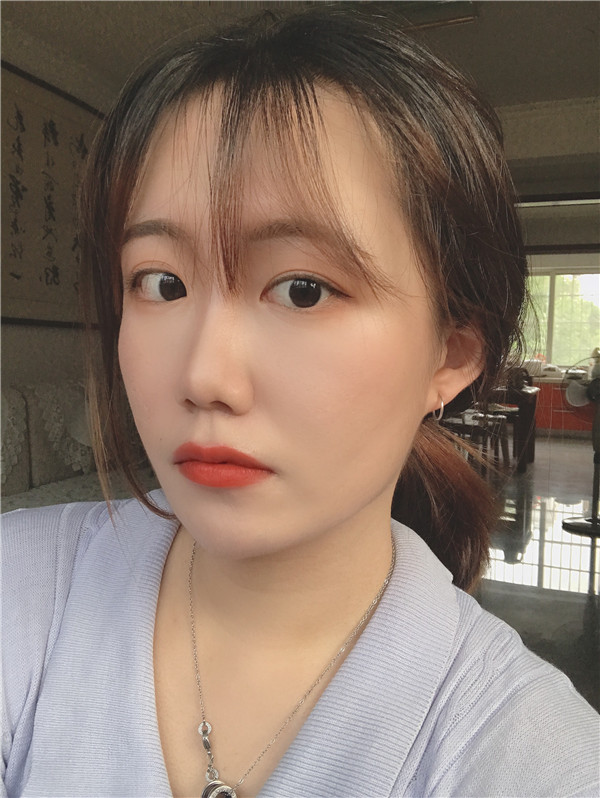 北京艾玛医疗白馨月M唇手术怎么样?价格案例