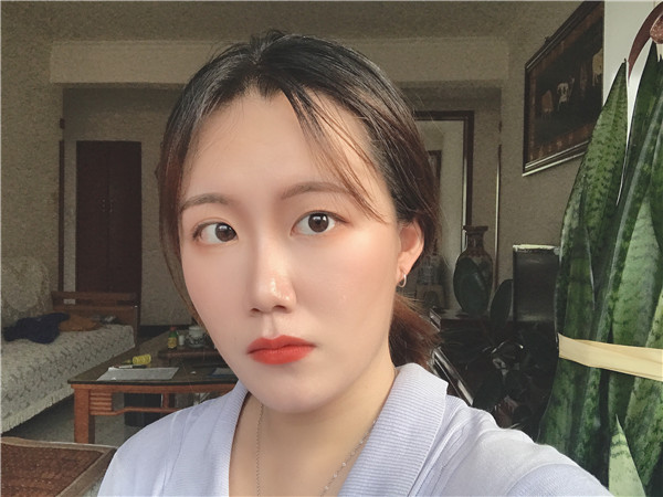 北京艾玛医疗白馨月M唇手术怎么样?价格案例