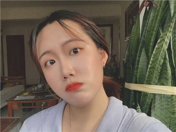 北京艾玛医疗白馨月M唇手术怎么样?价格案例