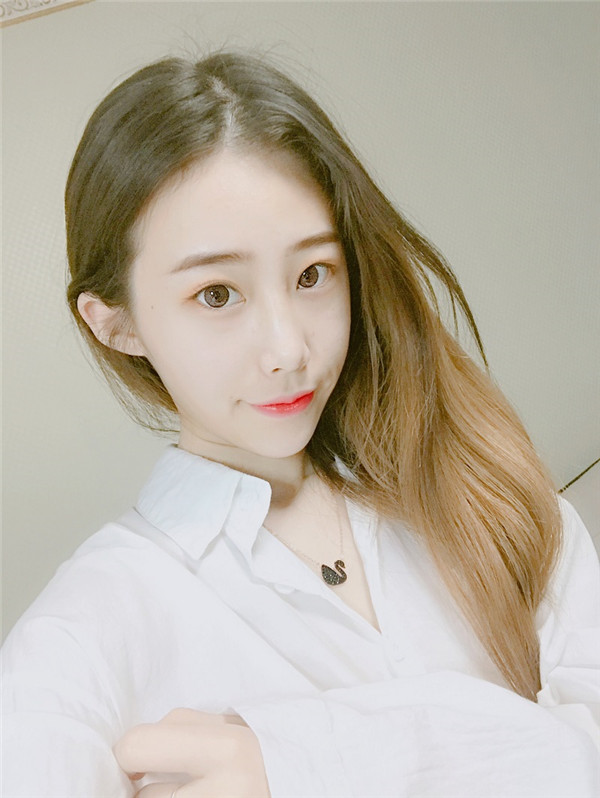 郑州管城赵灵卿李继峰隆鼻怎么样?价格案例