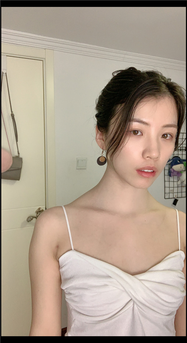 北京清菡聚美刘冲吸脂怎么样?价格案例