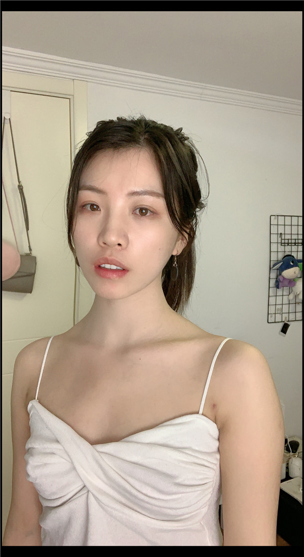 北京清菡聚美刘冲吸脂怎么样?价格案例