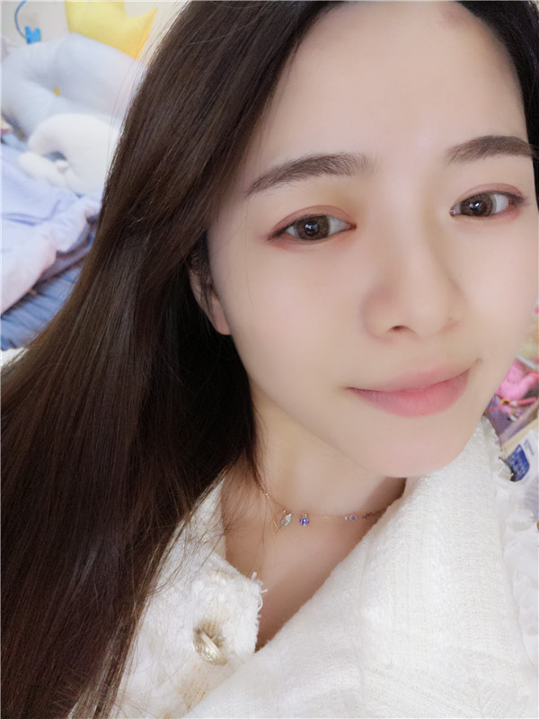 武汉新至美聂祝锋鼻部手术怎么样?价格案例