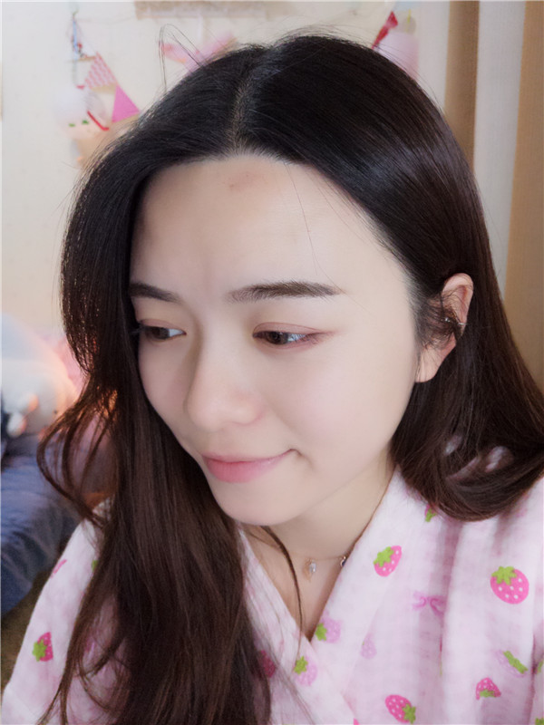 武汉新至美聂祝锋鼻部手术怎么样?价格案例