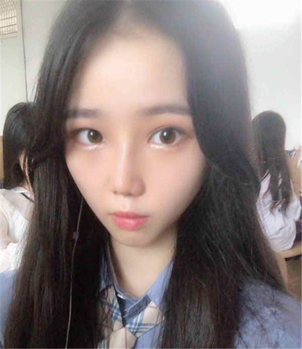 武汉媄妲医疗郑竞帆鼻部手术怎么样?价格案例