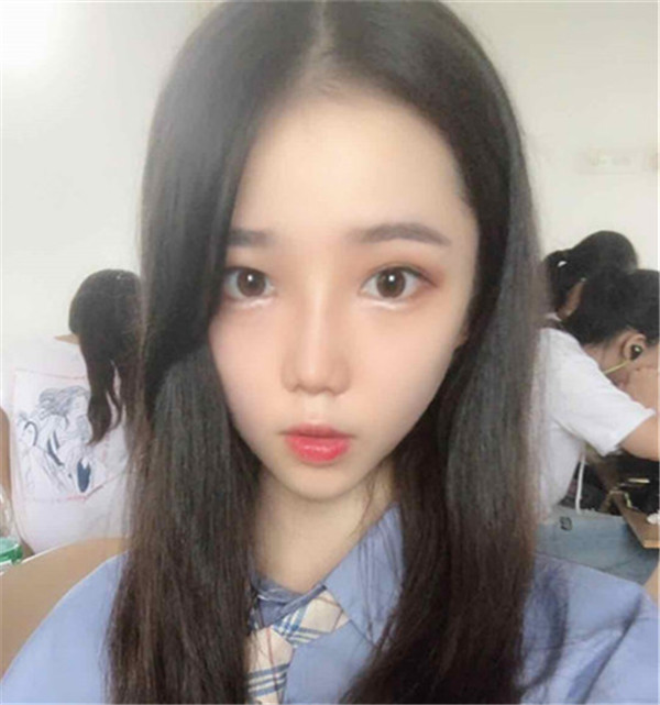 武汉媄妲医疗郑竞帆鼻部手术怎么样?价格案例