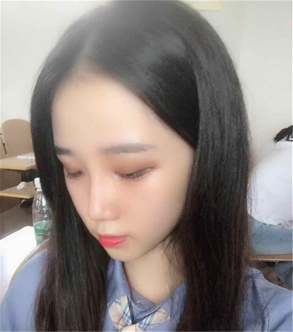 武汉媄妲医疗郑竞帆鼻部手术怎么样?价格案例