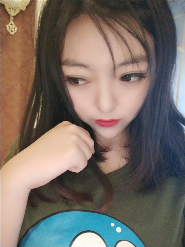 淄博美联臣整形医院杨辉脂肪填充怎么样?价格案例