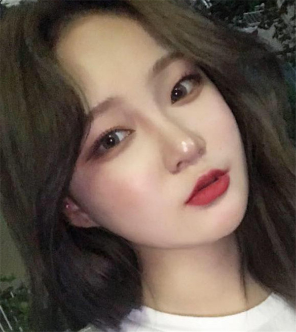 常州美贝尔整形邹志英鼻部手术怎么样?价格案例