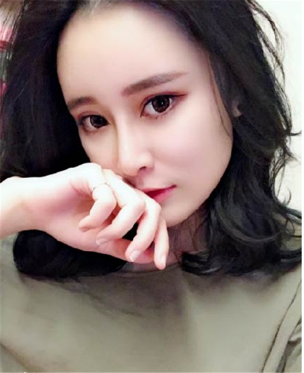 大连光普医美整形刘大伟鼻部手术怎么样?价格案例