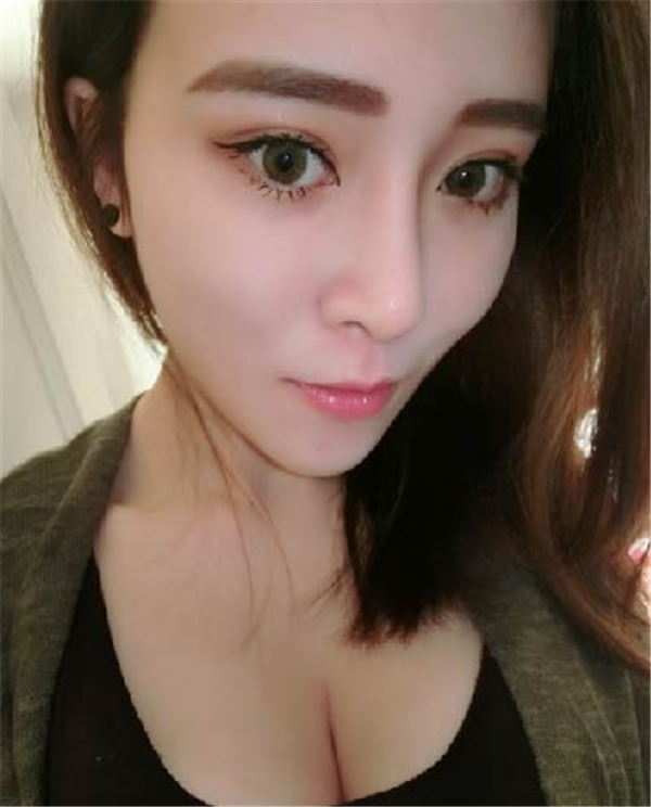 大连光普医美整形刘大伟鼻部手术怎么样?价格案例