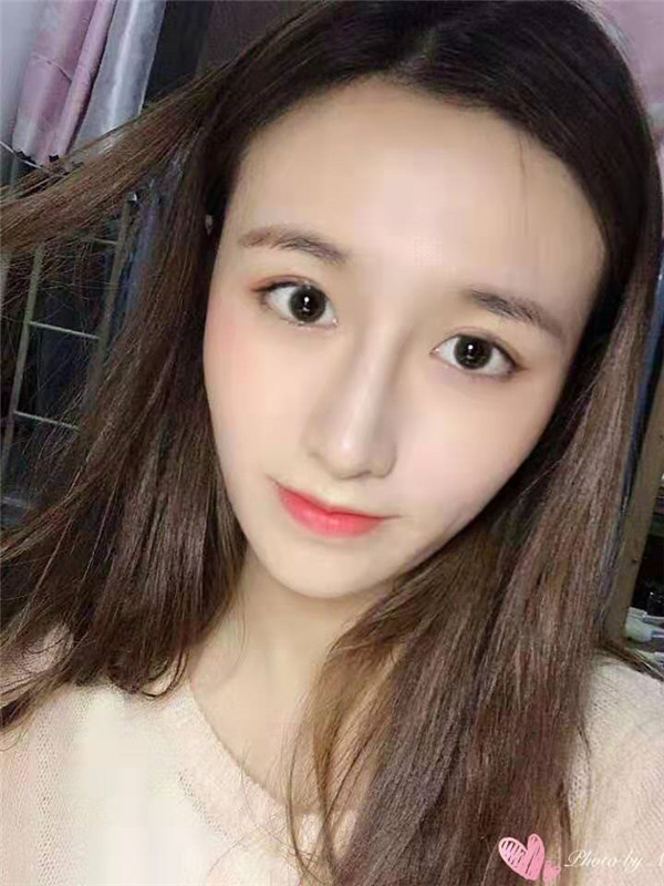 合肥壹美尚整形医院唐振利鼻部手术怎么样?价格