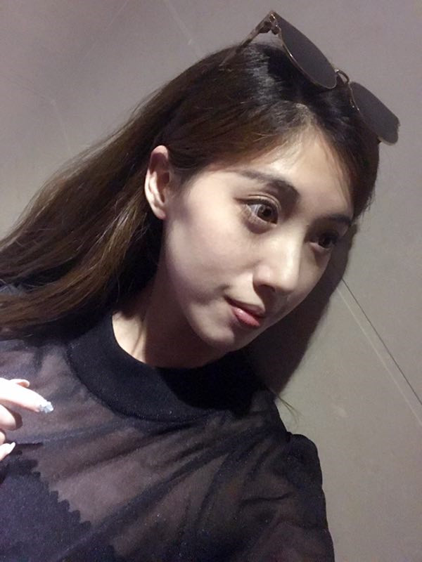 长春中妍硅胶隆鼻怎么样?价格案例