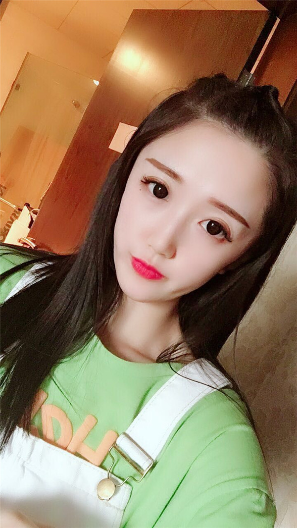 河南整形医院鲁华眼部手术好吗?价格案例