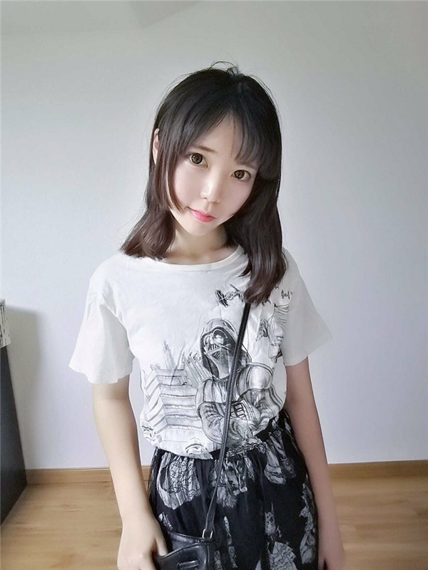 珠海科美医疗张民望脂肪填充怎么样?价格案例