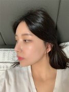 普瑞美整形医院鼻修复怎么样？价格案例