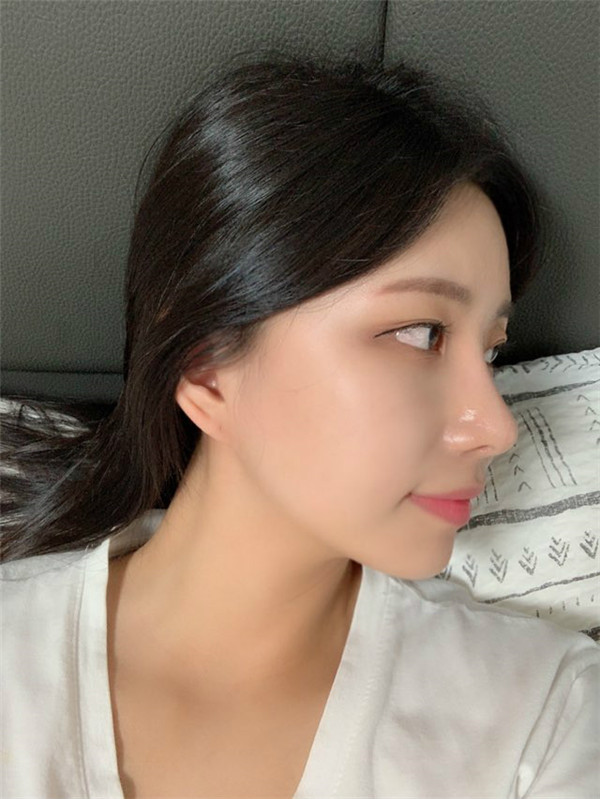 普瑞美整形医院鼻修复怎么样?价格案例