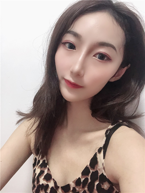 北京艾玛医疗白馨月做M唇怎么样?价格案例