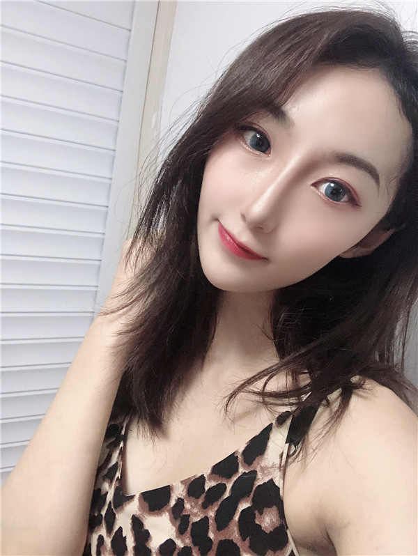 北京艾玛医疗白馨月做M唇怎么样?价格案例
