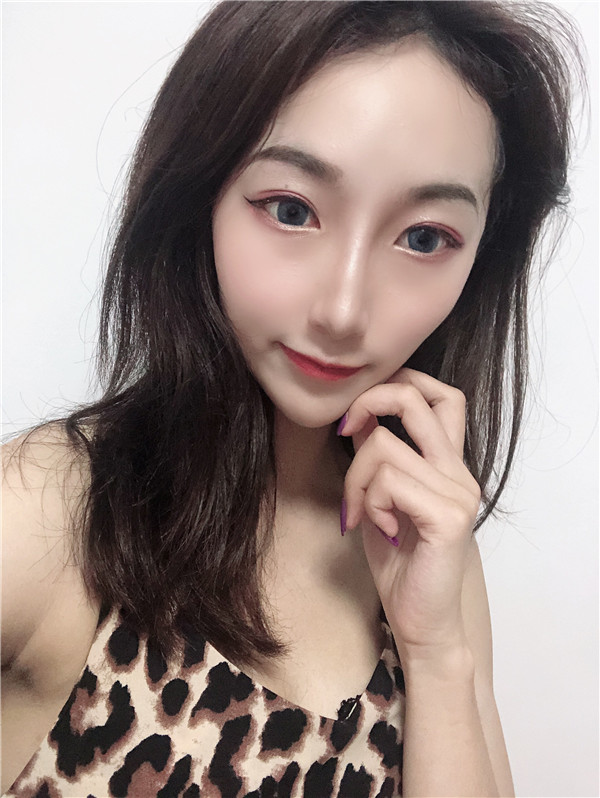 北京艾玛医疗白馨月做M唇怎么样?价格案例