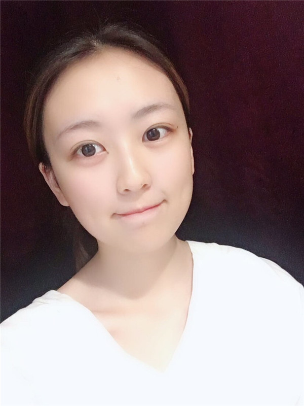 武汉伊美馨桂亮脂肪丰额头怎么样?价格案例