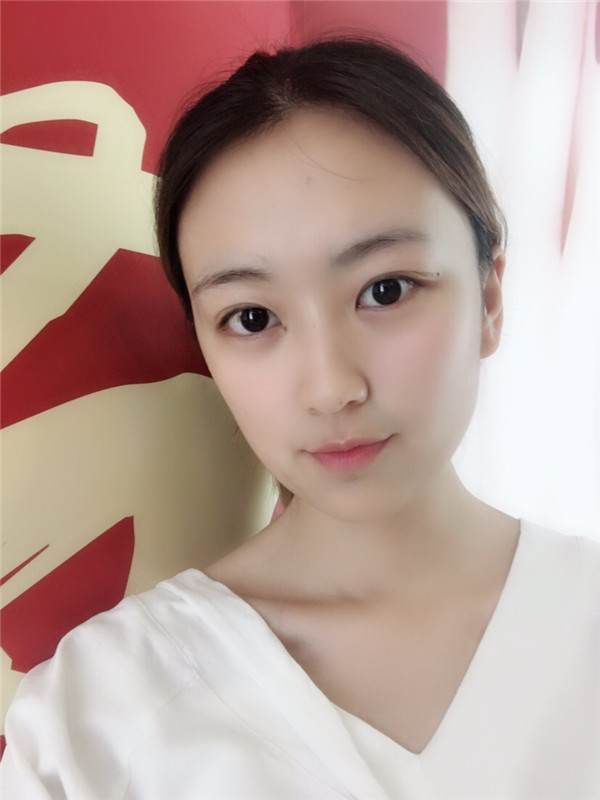 武汉伊美馨桂亮脂肪丰额头怎么样?价格案例
