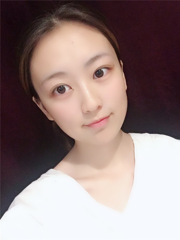 武汉伊美馨桂亮脂肪丰额头怎么样?价格案例