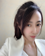 兰州崔大夫整形师芸红双眼皮怎么样？价格案例