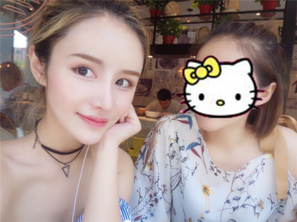 南宁悦星医疗朱小平鼻部手术怎么样?价格案例