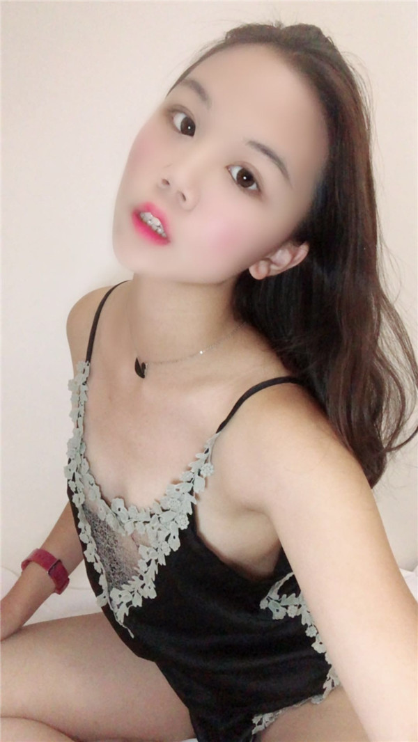 佛山广大壹美曹壁浪瘦脸怎么样?价格案例