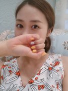 重庆瑞俪胡小义双眼皮怎么样？价格案例
