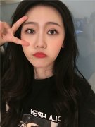 成都军建整形医院吕婧双眼皮怎么样？价格案