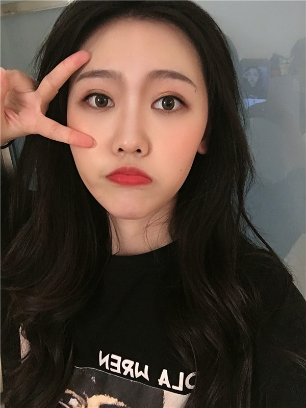 成都军建整形医院吕婧双眼皮怎么样?价格案