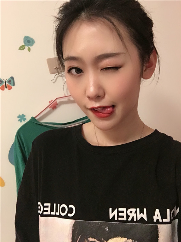 成都军建整形医院吕婧双眼皮怎么样?价格案