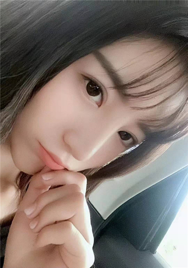 郑州童一颜李永胜脂肪丰面颊怎么样?价格案例