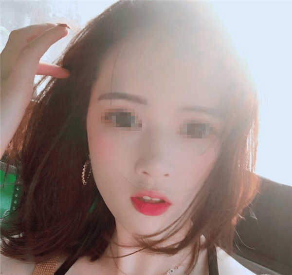 长沙中欧亚太廖小翠脂肪丰太阳穴怎么样?