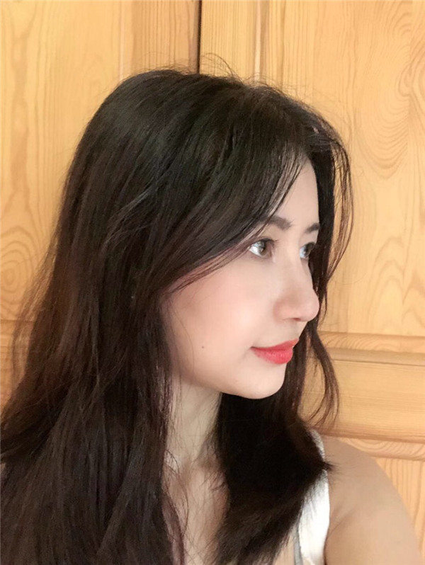成都心悦容杨硕鼻部手术怎么样?价格案例