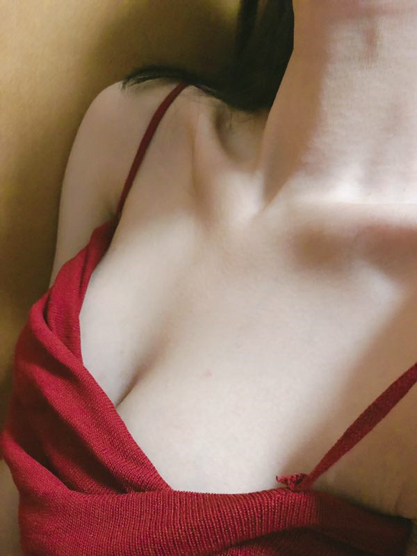 广州华美郝永生假体隆胸怎么样?价格案例