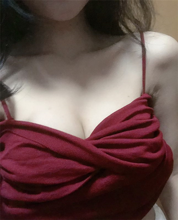 广州华美郝永生假体隆胸怎么样?价格案例
