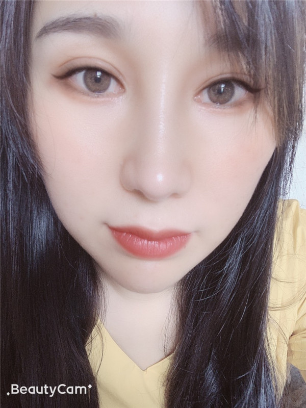 南京施尔美刘卫隆鼻怎么样?价格案例