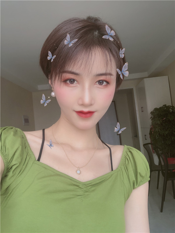 上海百达丽倪锋脂肪填充怎么样?价格案例