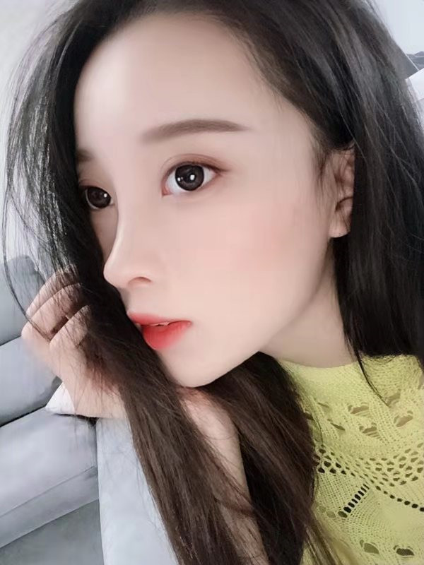 沈阳盛京尚美王超隆鼻怎么样?价格案例