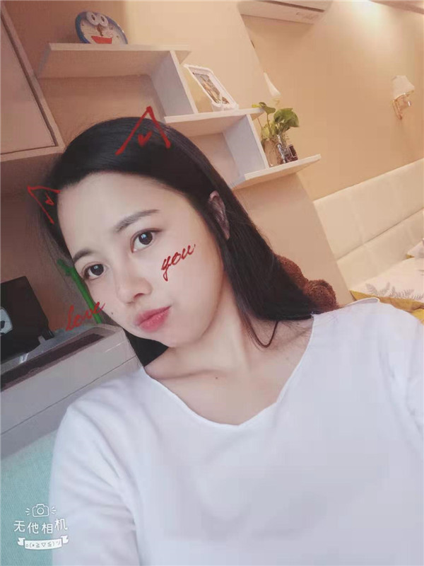 福州格莱美周秀峰隆鼻怎么样?价格案例