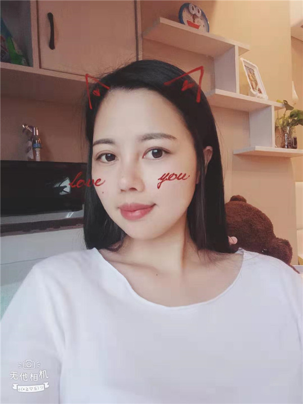 福州格莱美周秀峰隆鼻怎么样?价格案例