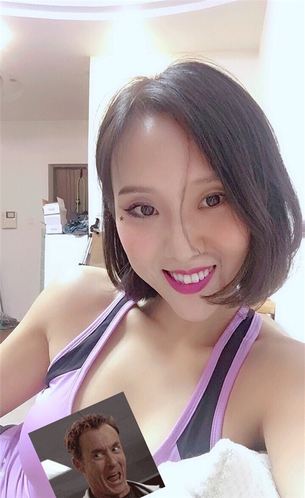 上海宏康口腔孔琳瓷贴面怎么样?价格案例