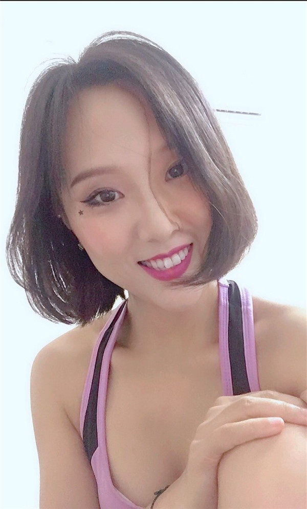 上海宏康口腔孔琳瓷贴面怎么样?价格案例