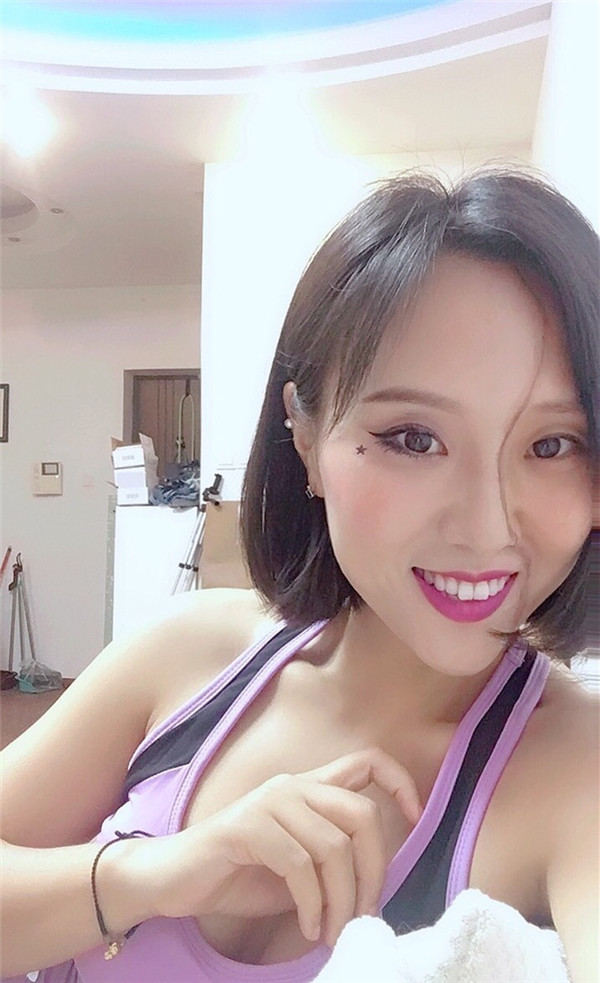 上海宏康口腔孔琳瓷贴面怎么样?价格案例