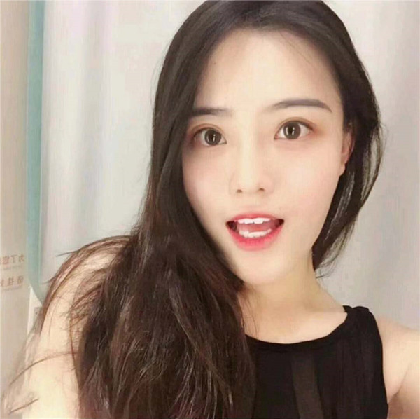 上海悦莱唐勇脂肪填充怎么样?价格案例