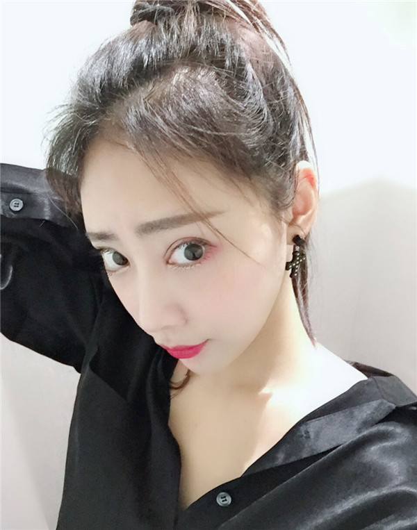 上海悦莱医院唐勇眼部手术怎么样?价格案例